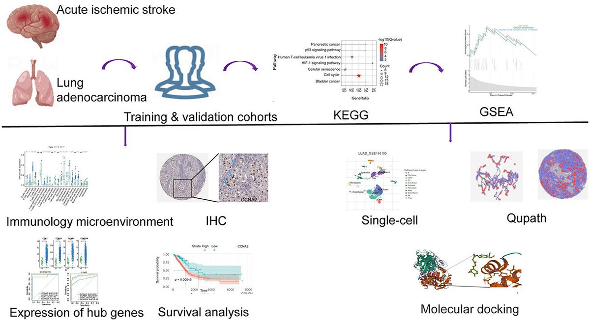 Researchers identify and annotate hub genes and their biological functions in acute ischemic #stroke and lung #adenocarcinoma. bit.ly/3oLnZIO CCNA2, CCNB1, CDKN2A, and CDK1 were highly expressed in AIS and LUAD tissue samples compared to controls. #singlecell