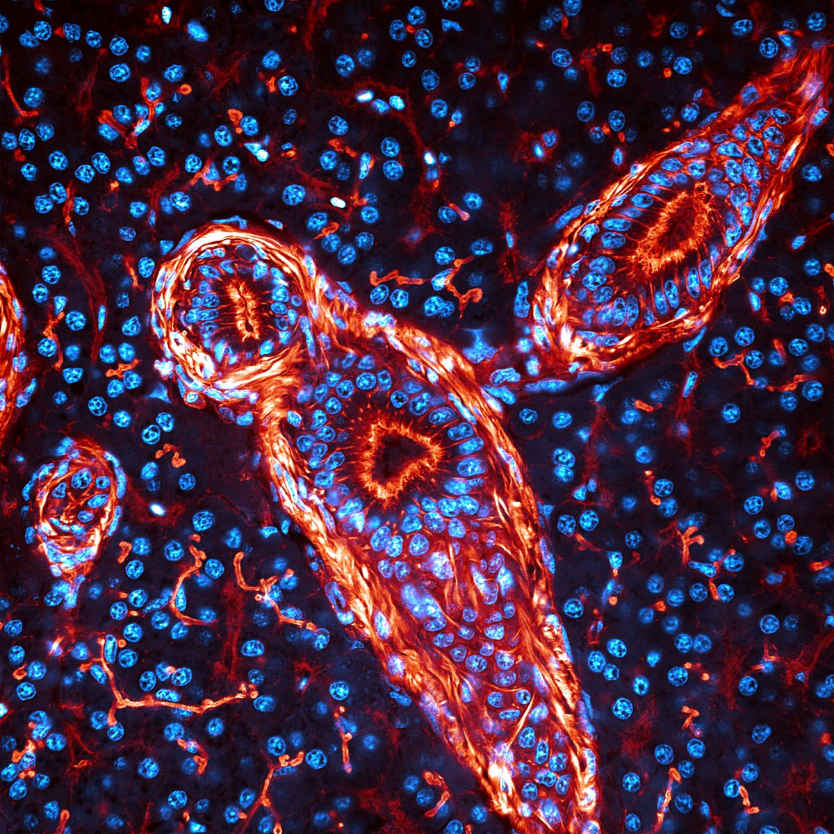 Adult zebrafish liver - The bright structures are bile ducts that are surrounded by smooth muscles.

#Science #Microscopy #Sciart #liver #Zebrafish