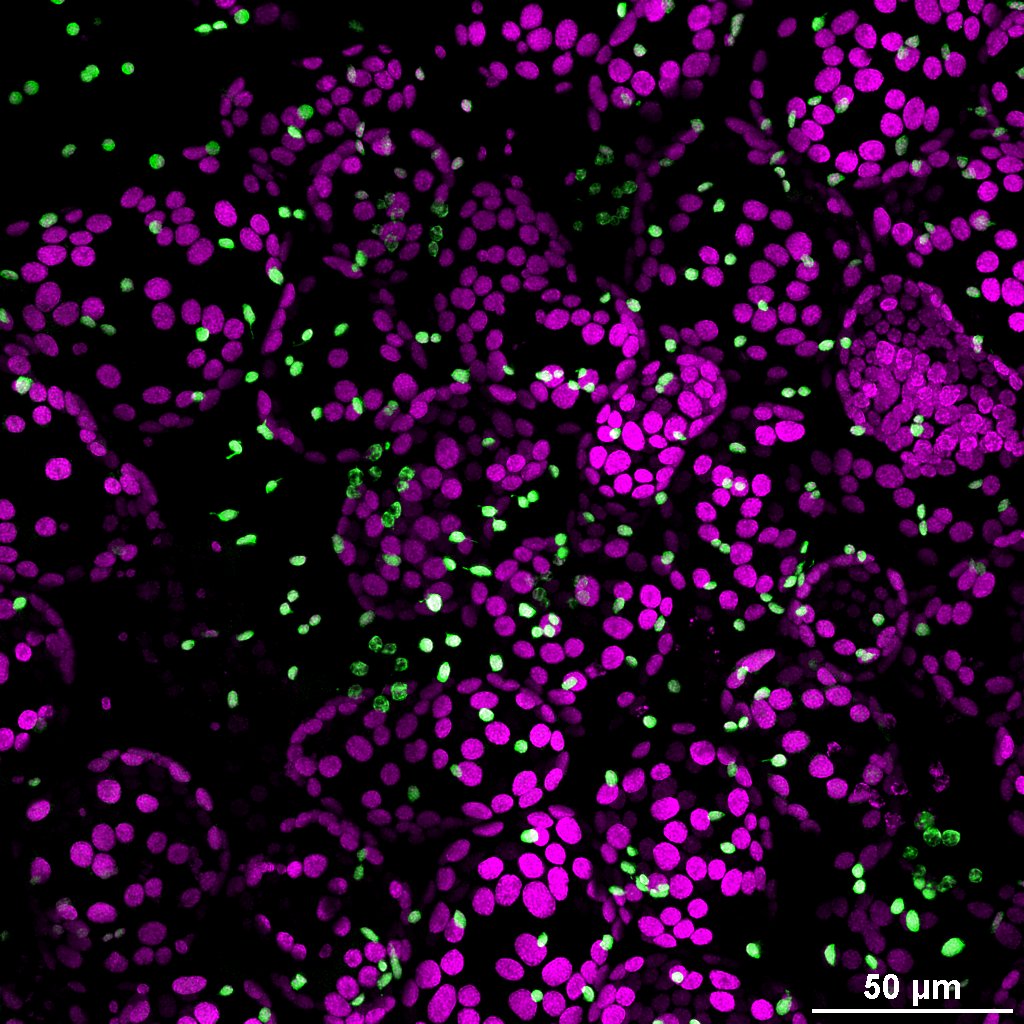 I had so much fun testing the Nikon AX-R confocal from @NikonInst. I got to test an awesome 40x/NA 1.15 water objective with 600 um WD.
Using this objective, we made this image of different types of plastids in the Arabidopsis. 
#cellbiology #plants #plastids #microscopy