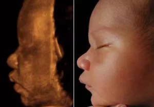 JefinhoMenes's tweet photo. 🚨Atenção pediatras, grávidas, téc ultrassom ou parente de grávida que me segue 🚨

Estou participando de um projeto para melhora de imagens do ultrassom por inteligência generativa.

Me manda DM se você tiver um ultrassom bom do bebê e queira participar. É de graça :) https://t.co/DgcF4ZTO6M
