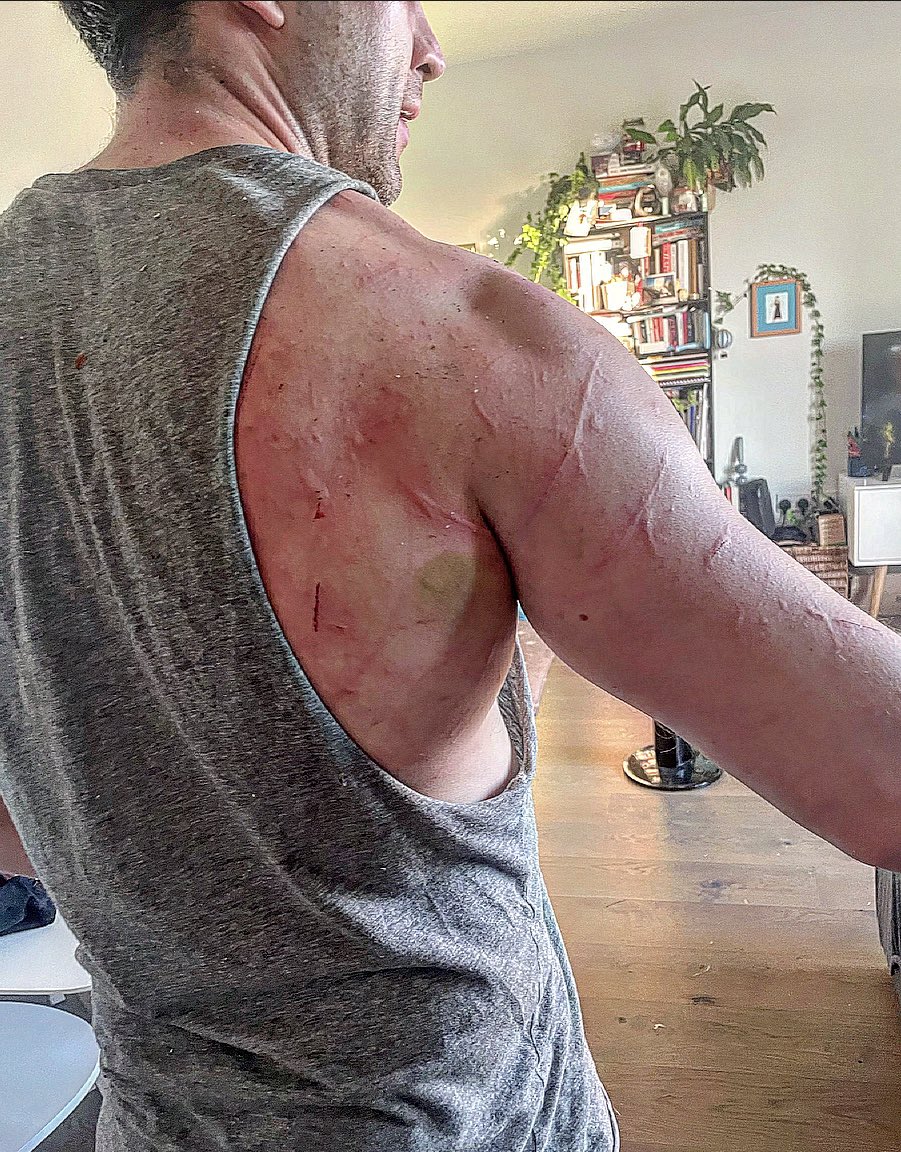 GarethTempest's tweet photo. Tell me your dog chased a fox into the undergrowth without telling me your dog chased a fox in to the undergrowth #HeisFine #HeisanArseholebutHeisFine https://t.co/JePqFsqGxH