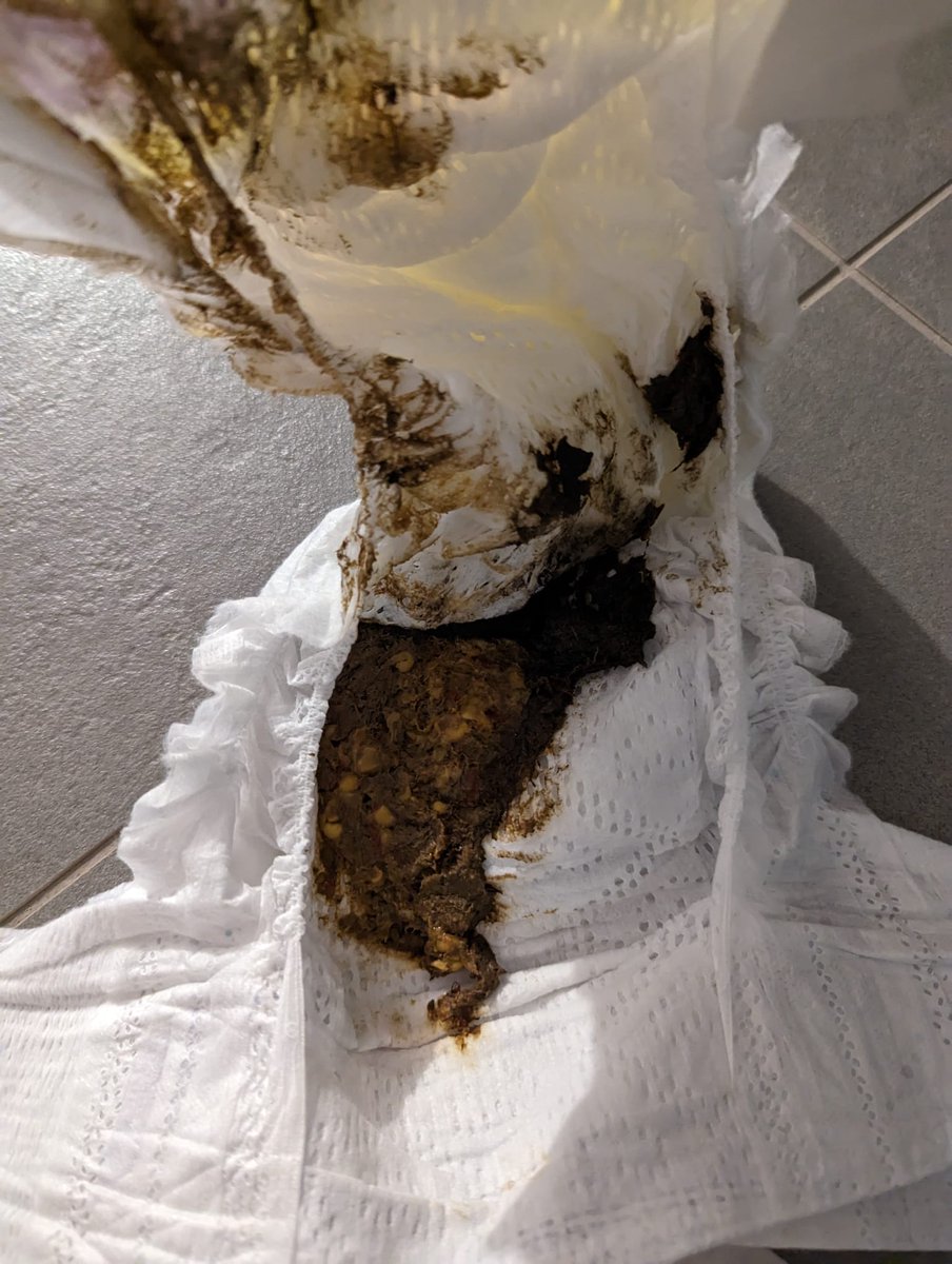 DookieDiaper's tweet photo. Life in crypto can be messy, just like a diaper full of surprises! 💩💰 Embrace the chaos, ride the waves, and remember that even in the messiest moments, there's always a chance for a hilarious plot twist.  😄🚀 #CryptoHumor #PlotTwist https://t.co/pHEaUkWqwP