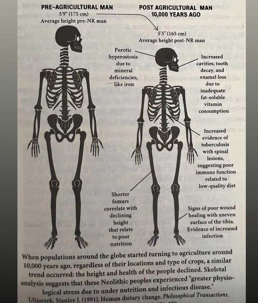 anthony_chaffee's tweet photo. This is what eating more plants did to us... Stop the cycle of abuse; put down the salad fork and eat a steak.

Evolving Human Nutrition
Stanley J Ulijaszek, Cambridge University

#diet #nutrition #carnivore #keto https://t.co/LOsmFtRZaG
