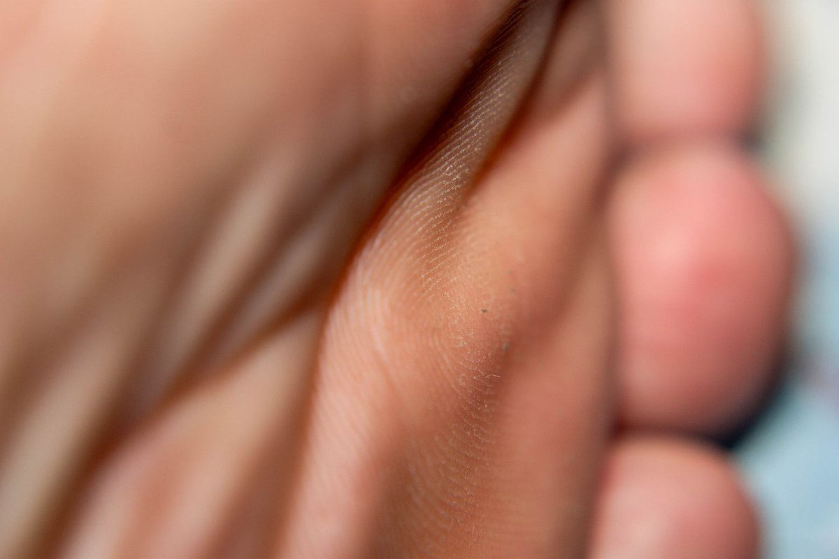 TigerFeet90's tweet photo. Macro shot
 #feet #toes #beautiful #footfetishnation #foot #soles #pretty_feet #macro #macroshot #macrophilia #macrofeet #feetfetish #malefeet https://t.co/caW0V44Kof