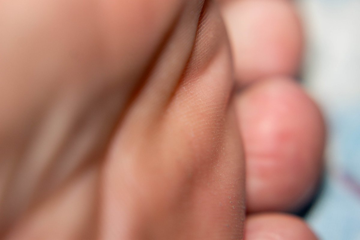 TigerFeet90's tweet photo. Macro shot
 #feet #toes #beautiful #footfetishnation #foot #soles #pretty_feet #macro #macroshot #macrophilia #macrofeet #feetfetish #malefeet https://t.co/caW0V44Kof