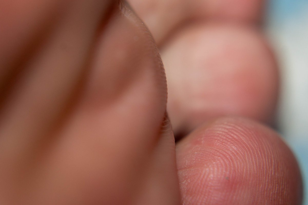 TigerFeet90's tweet photo. Macro shot
 #feet #toes #beautiful #footfetishnation #foot #soles #pretty_feet #macro #macroshot #macrophilia #macrofeet #feetfetish #malefeet https://t.co/caW0V44Kof