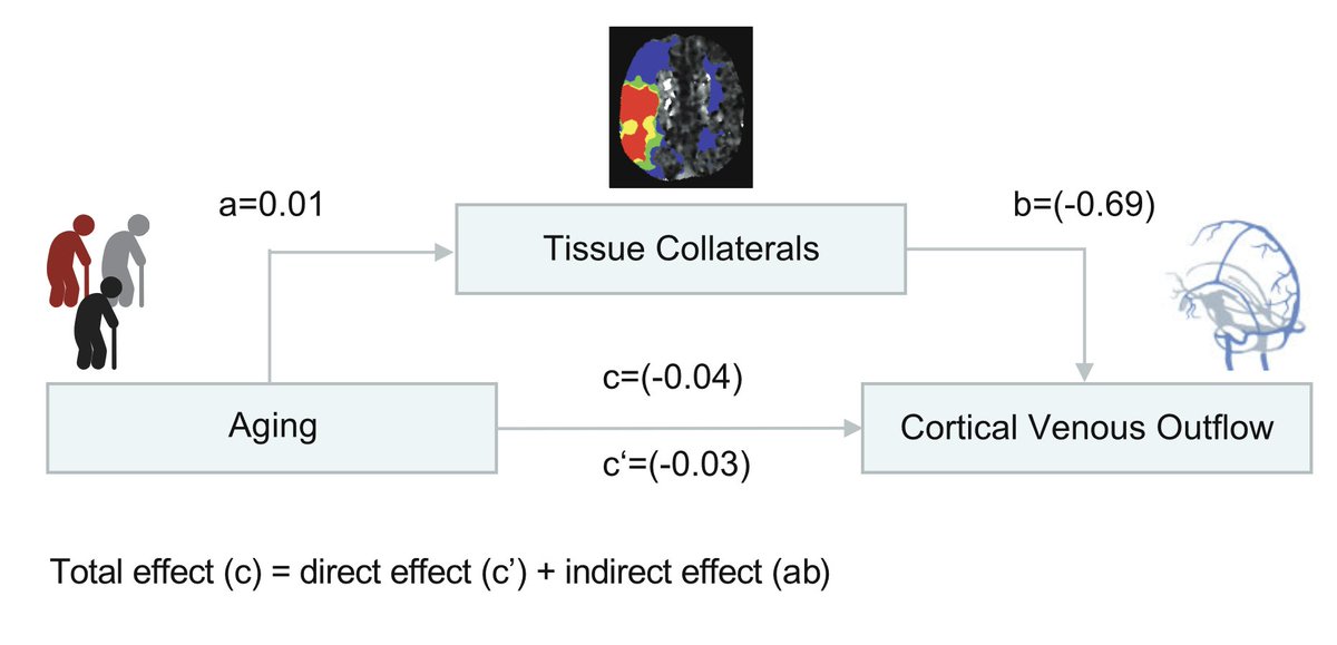 Jens Fiehler (@fie0815) on Twitter photo Higher age bad for venous outflow in stroke. bit.ly/43WP8HB Effect mainly mediated by degree of microvascular hypoperfusion (HIR, 17.3%). <a href="/ESOstroke/">European Stroke Org</a> <a href="/esmintsociety/">ESMINT Society</a> <a href="/RapidAI/">RapidAI</a> <a href="/BroocksGabriel/">Gabriel Broocks</a> <a href="/CSI_Basel/">Clinical Stroke & Imaging Analysis Lab Basel</a> <a href="/CSI_Lab/">Clinical Stroke and Imaging Research</a> <a href="/DoctorGaldamez/">Mario Martínez-Galdámez</a> <a href="/DGNR_org/">Deutsche Gesellschaft für Neuroradiologie (DGNR)</a> Higher age bad for venous outflow in stroke. bit.ly/43WP8HB Effect mainly mediated by degree of microvascular hypoperfusion (HIR, 17.3%). <a href="/ESOstroke/">European Stroke Org</a> <a href="/esmintsociety/">ESMINT Society</a> <a href="/RapidAI/">RapidAI</a> <a href="/BroocksGabriel/">Gabriel Broocks</a> <a href="/CSI_Basel/">Clinical Stroke & Imaging Analysis Lab Basel</a> <a href="/CSI_Lab/">Clinical Stroke and Imaging Research</a> <a href="/DoctorGaldamez/">Mario Martínez-Galdámez</a> <a href="/DGNR_org/">Deutsche Gesellschaft für Neuroradiologie (DGNR)</a>