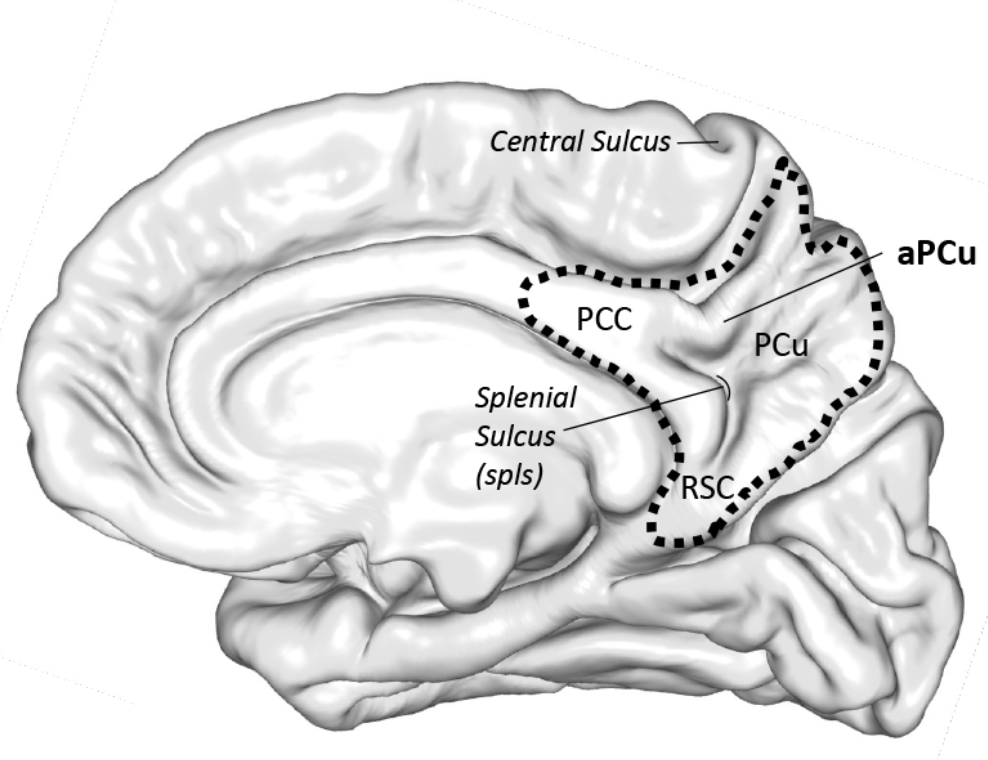 No it is NOT the default mode network! 
We are reporting a brain region and its connected network that is causally important for constructing a sense of physical self - when perturbed, a sense of dissociation is induced. doi.org/10.1016/j.neur…