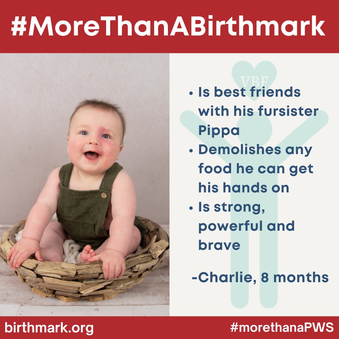 VBirthmarks's tweet photo. YOU are MORE than your Birthmark...I am MORE than MY Birthmark...

#VBF launched the “More Than” Project so that we can learn about you. Learn more at: https://t.co/zXuvJ79XvE

#MoreThanABirthmark #VascularBirthmarksFoundation #vascularbirthmarks #MTAB https://t.co/JV9sbcqyo9