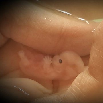 This is an unborn baby 7 weeks after fertilization. NOT a 'clump of cells.'

lifenews.com/2023/06/14/twi…