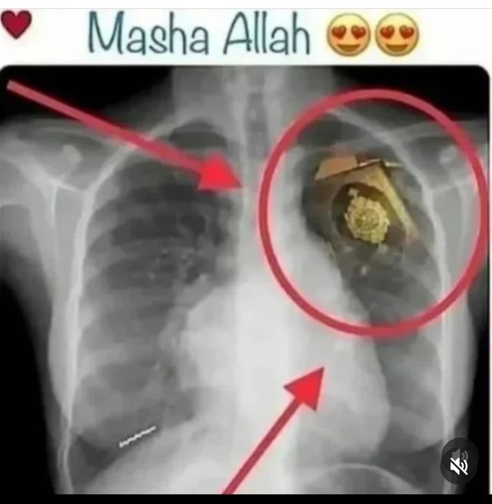 siyamaaaaa's tweet photo. Best picture. Retweet and comment Ma Sha Allah. https://t.co/fMkyn6mDtV