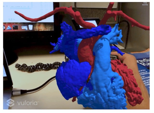 From 3D Printing to VR/AR: Simple Connection? bit.ly/3k6TcRu #ExpertCorner #medical3dprinting #bioprinting #3DTech