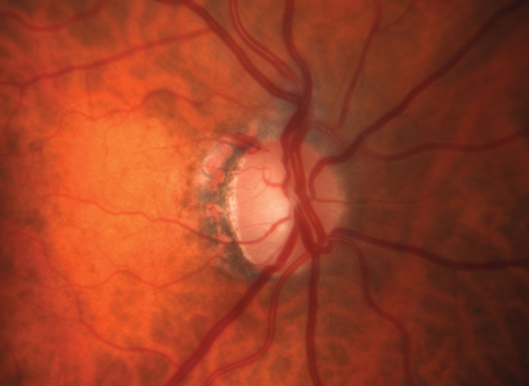 Review of Ophthalmology tweet media