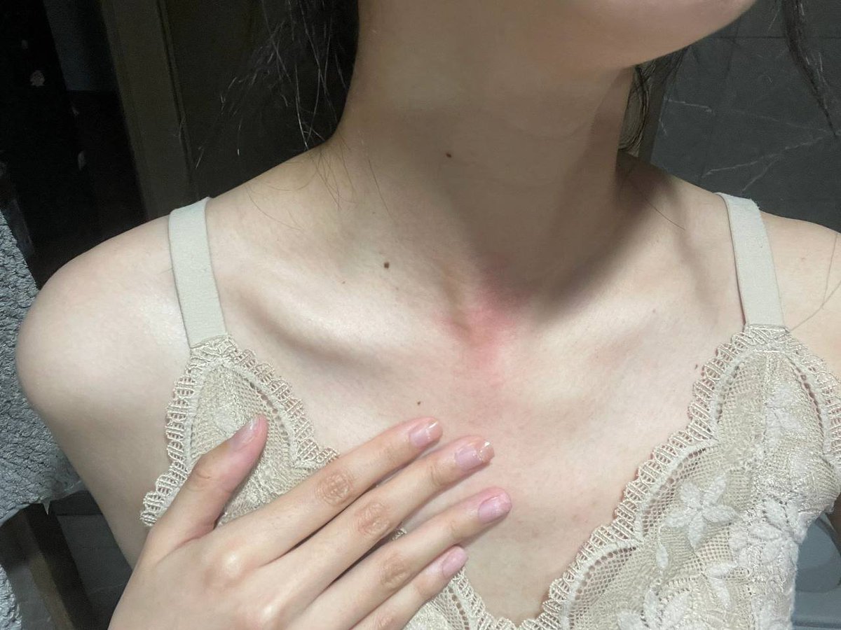 I have a fever, hope it gets better soon.