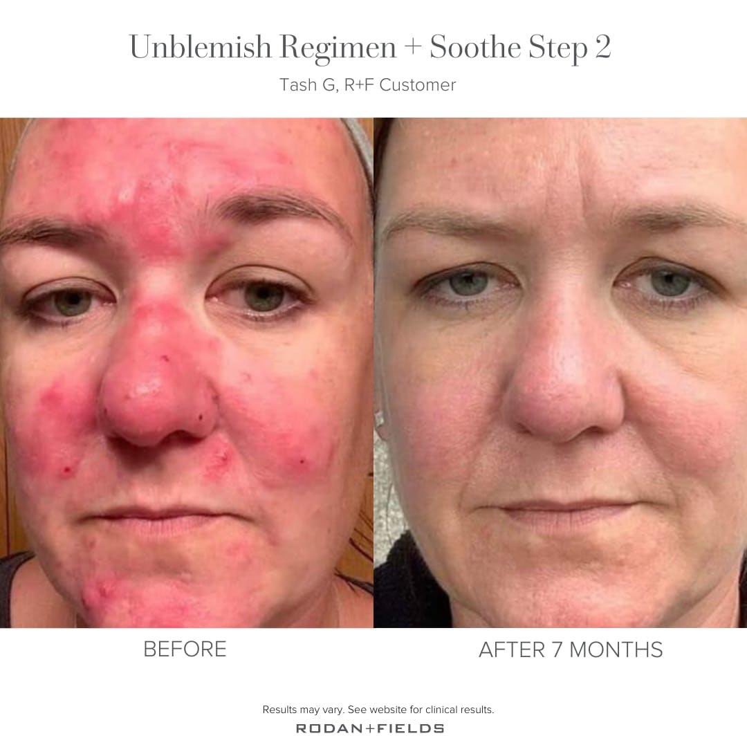 RFSkincareEnth1's tweet photo. Finding 👀 a good skincare routine is easier than you may think. 

Our multi-step Regimens take the guesswork out of building a routine that works.

Are you ready to #ExperienceRF? https://t.co/DWlkVbYAci