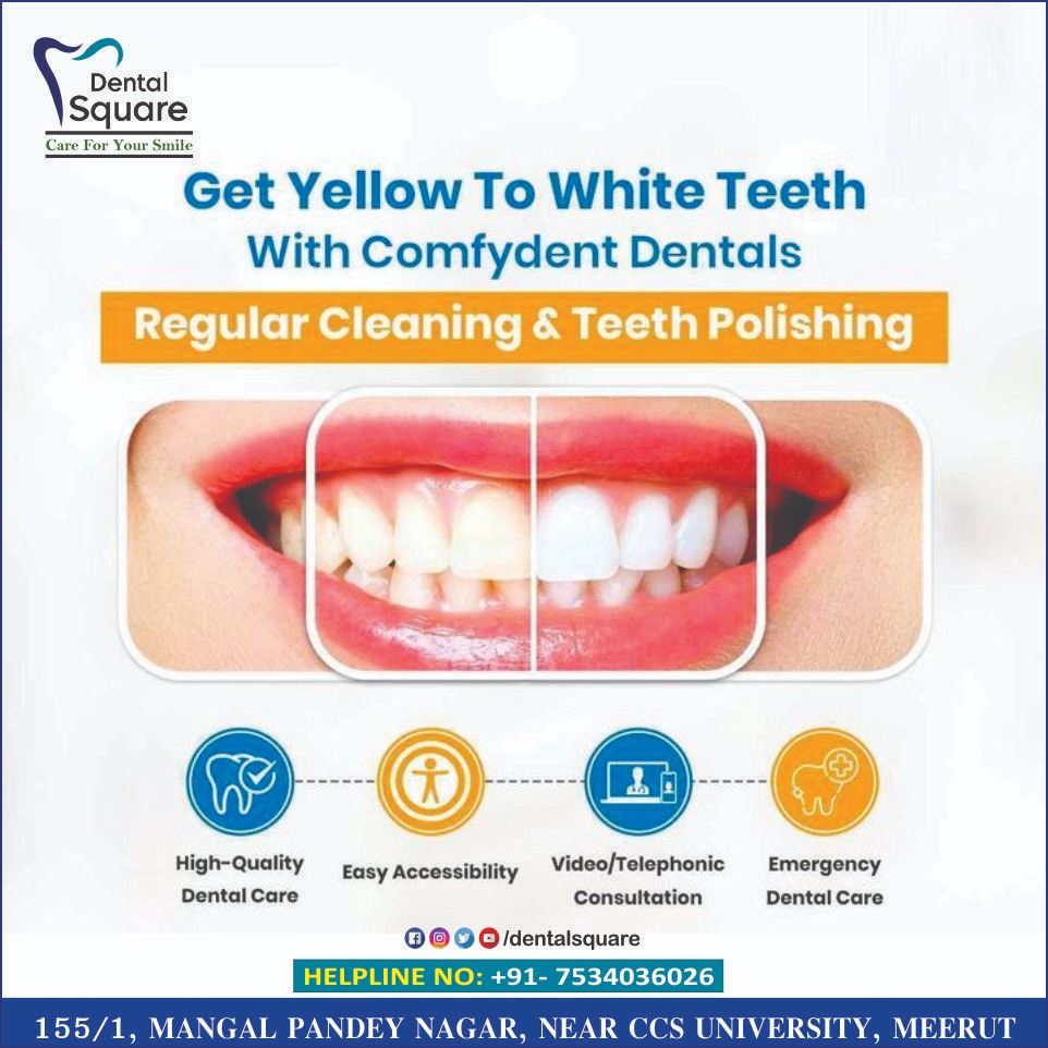 Dentalsquaremrt's tweet photo. 😁𝐆𝐞𝐭 𝐘𝐞𝐥𝐥𝐨𝐰 𝐓𝐨 𝐖𝐡𝐢𝐭𝐞 𝐓𝐞𝐞𝐭𝐡 𝐖𝐢𝐭𝐡 𝐂𝐨𝐦𝐟𝐲𝐝𝐞𝐧𝐭 𝐃𝐞𝐧𝐭𝐚𝐥𝐬
#dentalsquare #dentalclinic #dentalcare #dentalhealth #dentalproblem #teethcare #teethdisorder #gumproblem #meerutcant #sensitivity #Staininteeth #painortoothache #toothpainpose #smile https://t.co/6eLP3q6wTD