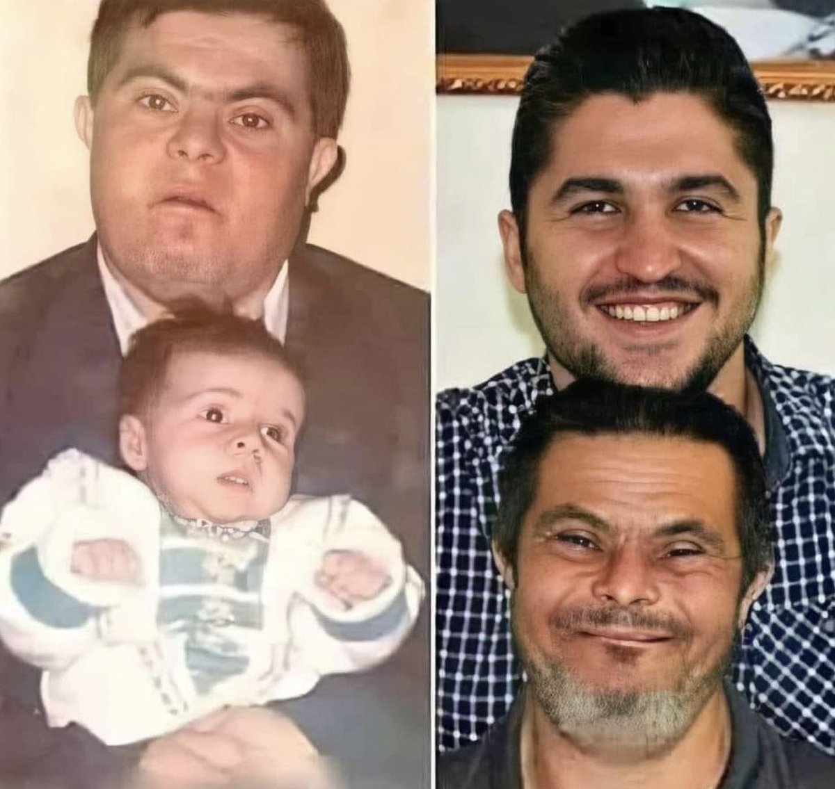 HalalNation_'s tweet photo. A father with Down syndrome raised his son who is now a doctor ❤️ 🥹 https://t.co/Grutxuk7CX