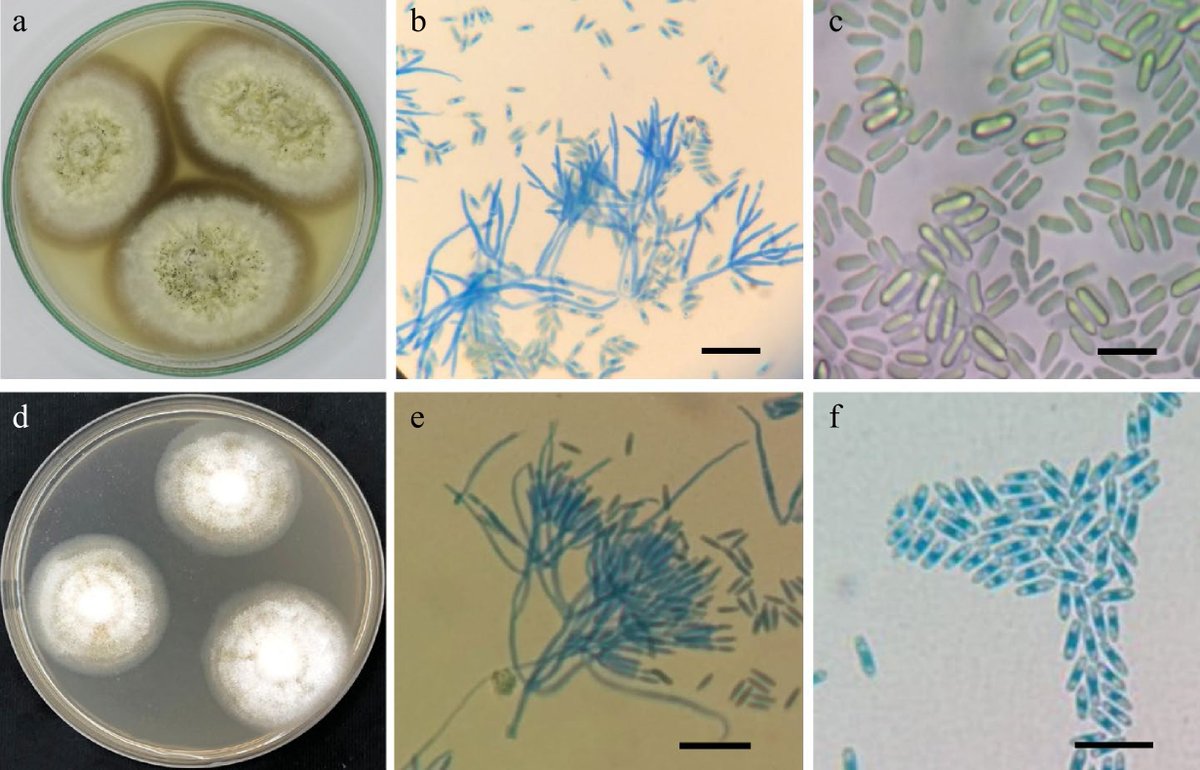 During soil fungal surveys in Egypt's New Valley Governorate, researchers have made fascinating findings. This discovery sheds light on the rich biodiversity of the region. 🌍
#ScientificDiscovery #FungalBiodiversity
Details: maxapress.com/article/doi/10…