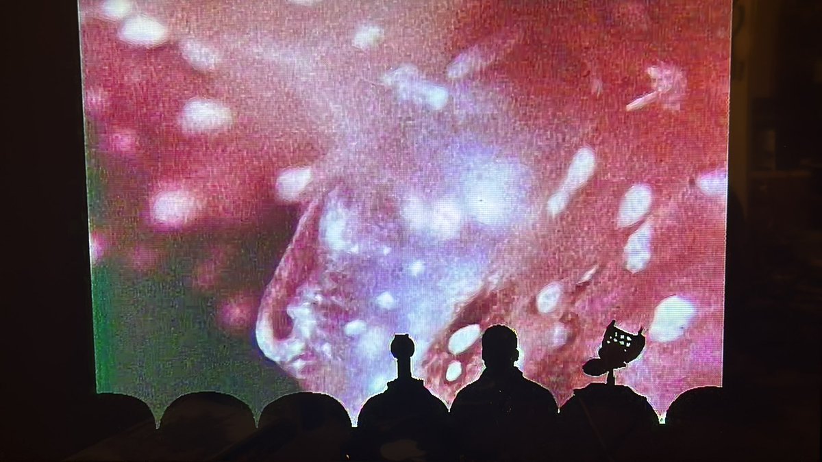 ‘Please enjoy a fish anus.’
#MST3K #BloodWatersofDrZ