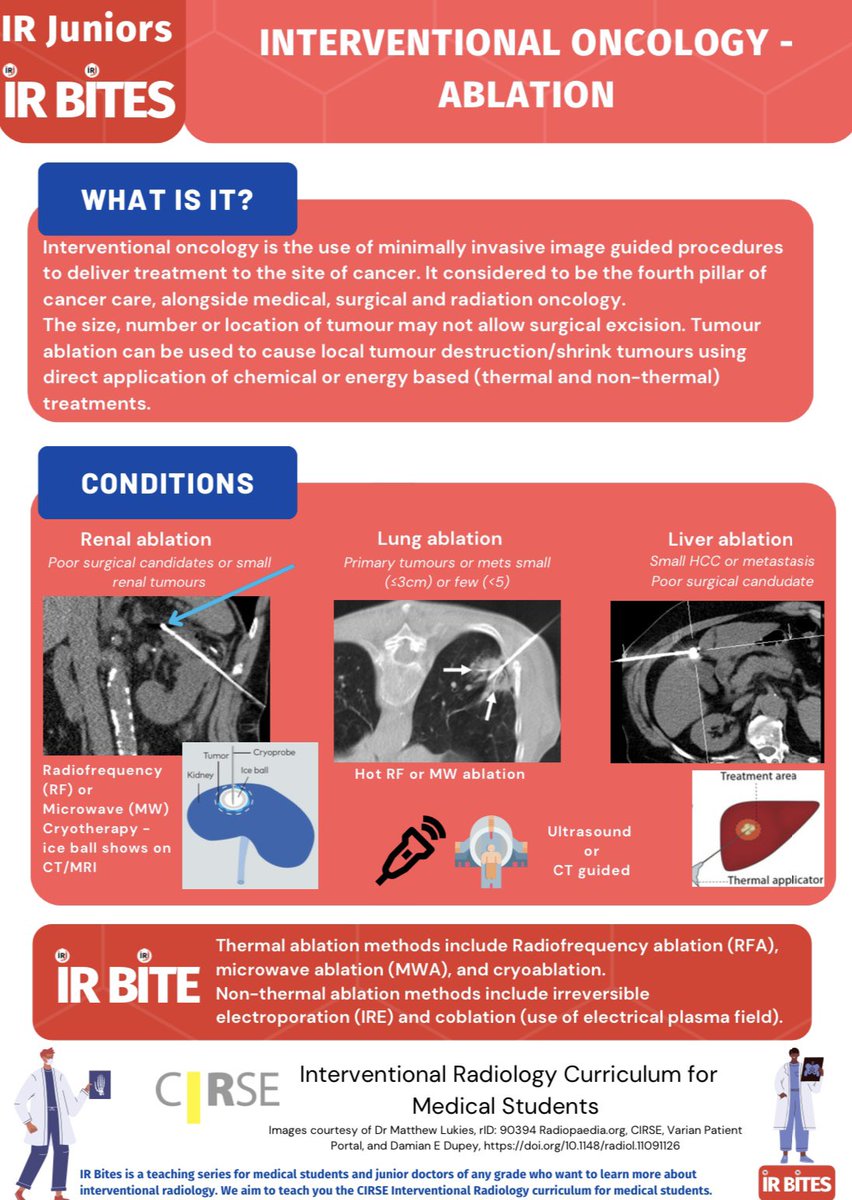 📣 Join us today at 7pm to find out more about Interventional Oncology! 

Sign up to IR bites 2.0 on MedAll: share.medall.org/events/ir-bite…

Here’s a sneak peek of tonights webinar. 

@IR_juniors @MedAllApp #medstudents #juniordoctors 
#irad #interventionaloncology