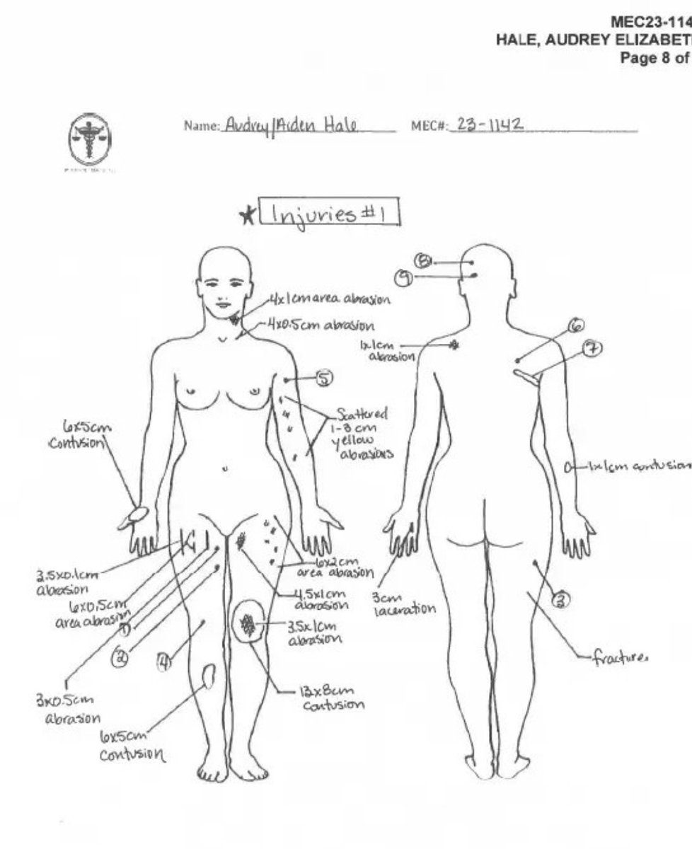 A page from Covenant school shooter Audrey Hale’s autopsy report. The irony that they used a female body diagram despite her ‘he/him’ bullshit.