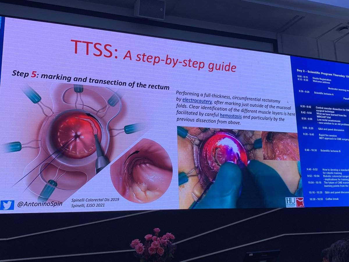 NuhaZsurgeon's tweet photo. The highly-skilled surgeon behind the tool - whether wielding a laparoscope or a robot - the key is accuracy and understanding of anatomical planes and steps of the procedure - TTSS presented by the amazing @AntoninoSpin @HumanitasCRS @PColorectal superb 👌🏽🤩 https://t.co/usy9mWrqrE