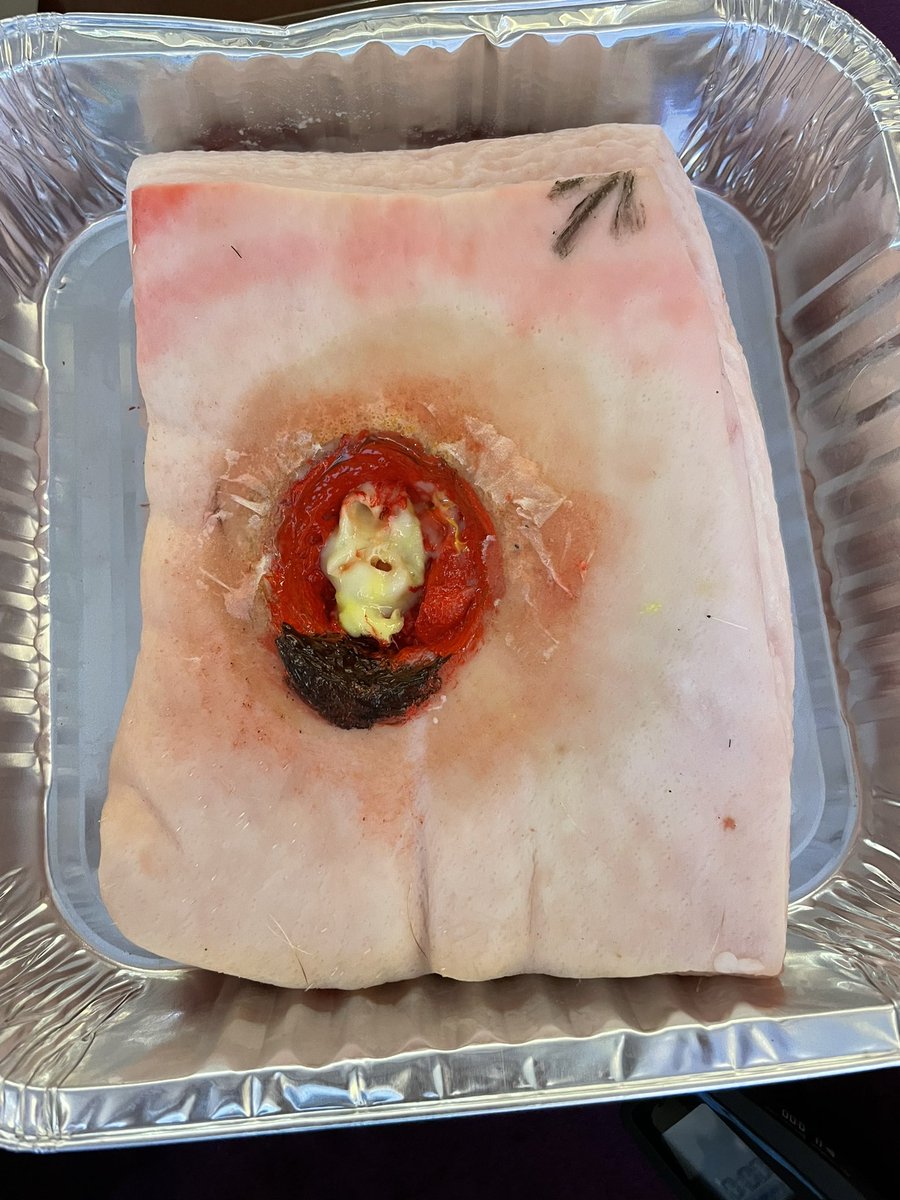 Looks pretty authentic for a wound model for debridement workshop in China.