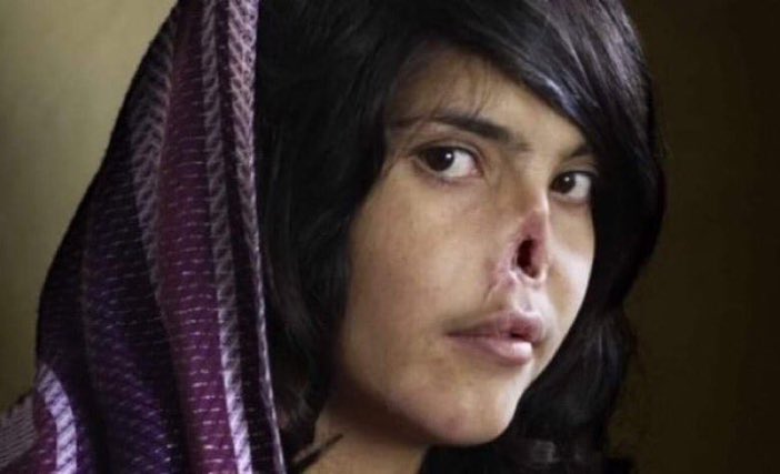 Seyahatname: Afganistan Günlükleri

Afganistan az gelişmiş bir ülkedir.
Okuma yazma oranı %10’un altında.
Kadınların oy kullanma hakkı yok.
Yüzü açık gezen kadının yüzüne kezzap atılmasının burnunun kesilmesinin doğal olduğu bir coğrafyadan bahsediyoruz.

Eğitimsiz ve kültürel…