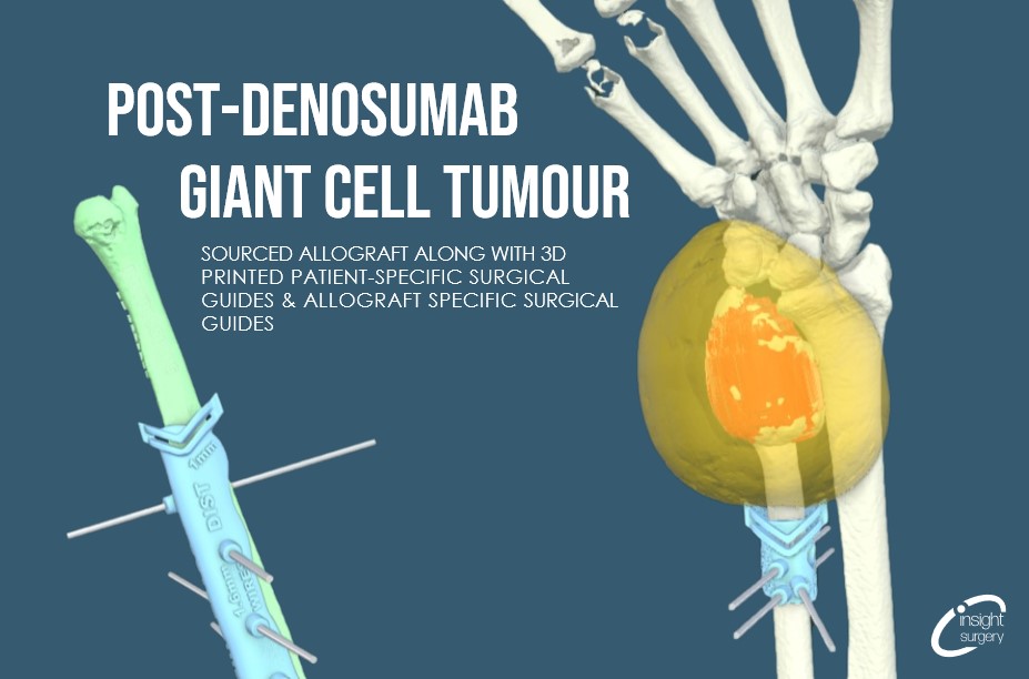 Insight Surgery tweet media