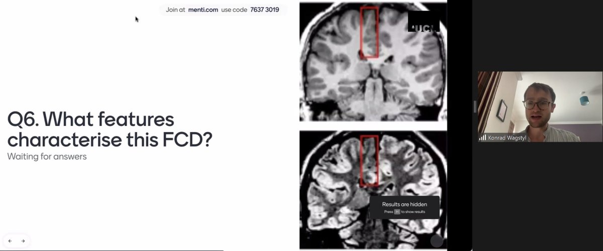 The MELD project tweet media