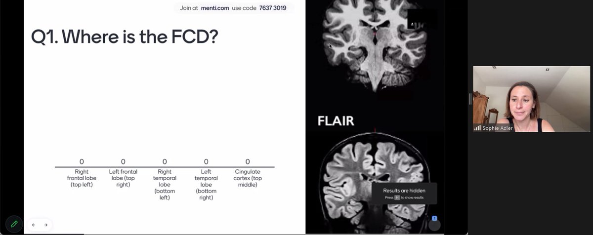 The MELD project tweet media