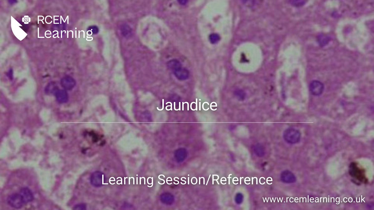 RCEMLearning's tweet image. UPDATED: This session deals with the assessment and management of jaundice. 

Learning Session🔒: rcemlearning.co.uk/modules/jaundi…
Reference🆓: rcemlearning.co.uk/reference/jaun…