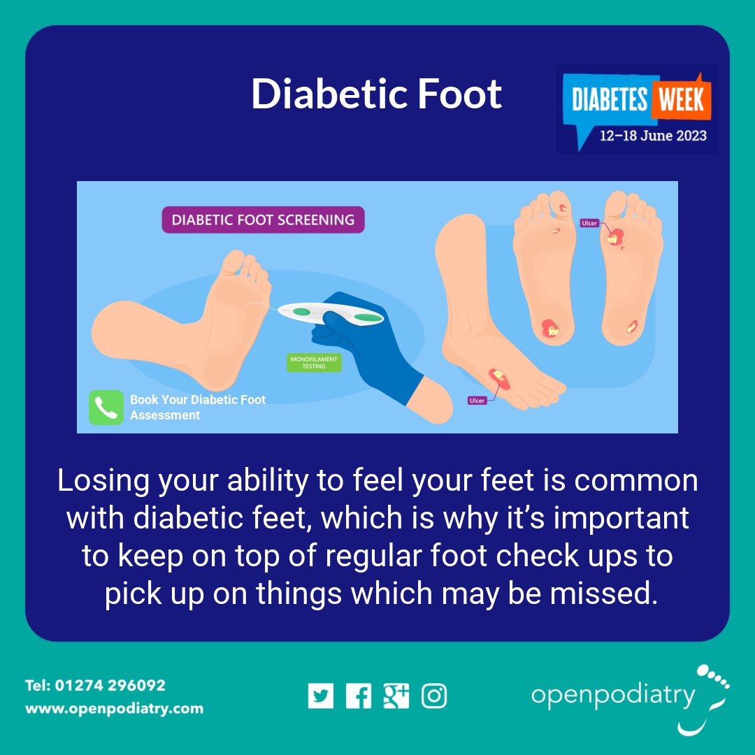 Diabetic #neuropathy is serious, lack of sensation often results in reduced response or action.

#Podiatry #feet #Bradford #footpain #diabetes #verruca  #nailcare #retweet #openpodiatry #pain #painfulfeet #nails #nailsurgery #insoles #diabetesweek #diabeticfoot #diabeticfeet