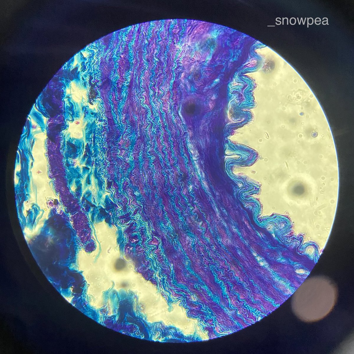 sharing wt u guys some of the prettiest histology slides i’ve seen in the lab 🥹💗

#studytwt #studytwtph