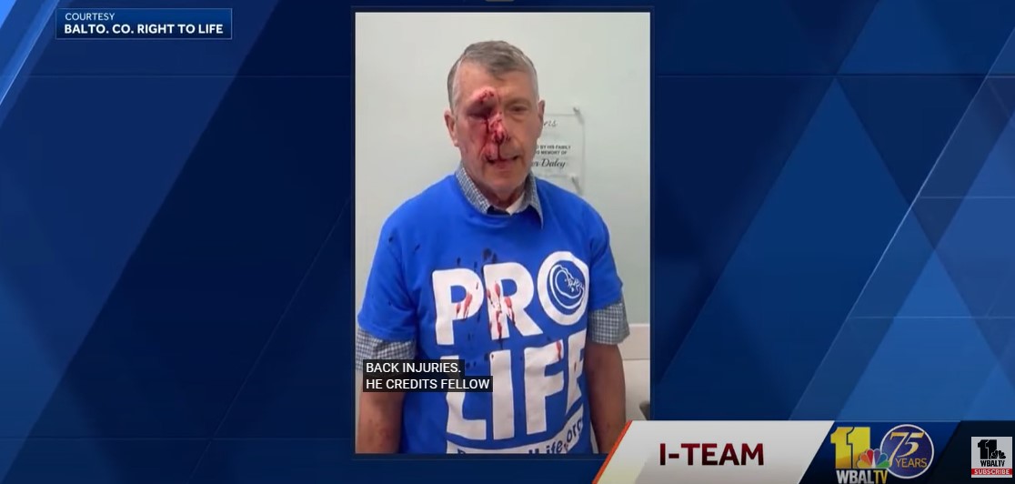 Two pro-life patriots were brutally attacked for peacefully protesting at a Planned Parenthood clinic. You can help these men by demanding justice, demand the authorities pursue their attackers! Sign here: bit.ly/440No01