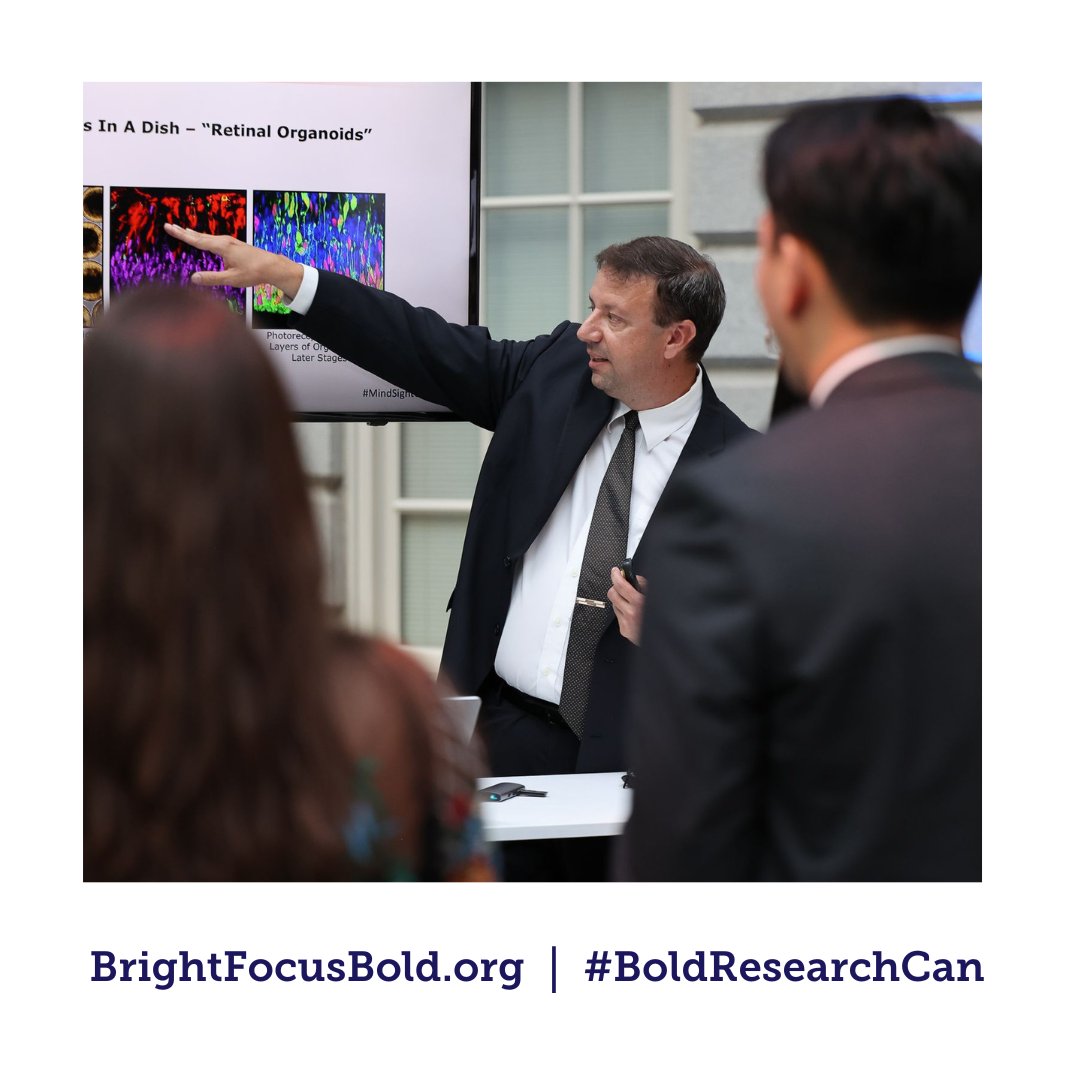 _BrightFocus's tweet photo. #TBT In 2016, BrightFocus grantee Jason Meyer, PhD & colleagues created & treated retinal ganglion cells derived from the skin cells of people with glaucoma— which could lead to treatments that prevent vision loss in glaucoma.
Learn more: https://t.co/LAhB4Ku5F8 #BoldResearchCan https://t.co/Q0tf3jrUdV
