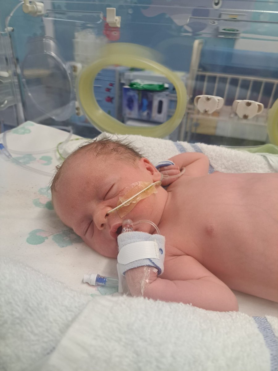 Tomorrow is #WearYellowDay for #CFWeek!

Please, whatever you do, do it in yellow to raise awareness of #CysticFibrosis so that more research can be funded to prevent future babies from going through what Rufus has.

Please donate to and help the <a href="/cftrust/">Cystic Fibrosis Trust</a>; cysticfibrosistrust.enthuse.com/pf/alexandra-o…