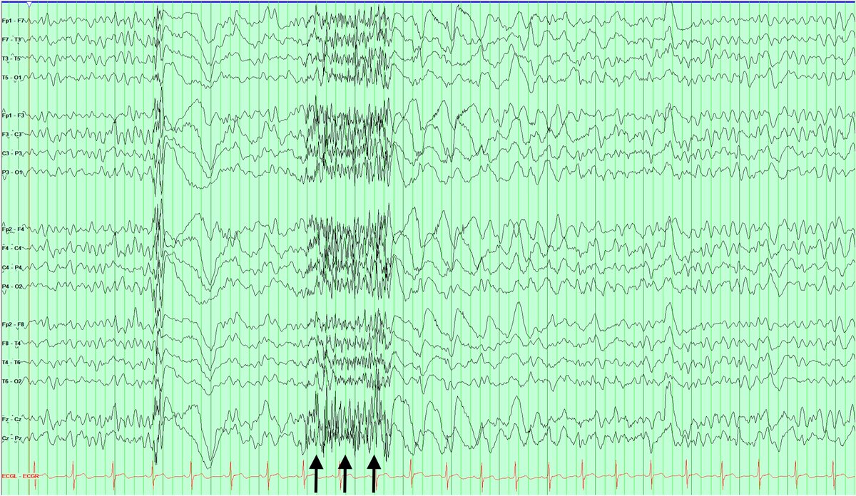 Rebecca E. Matthews, MD tweet media