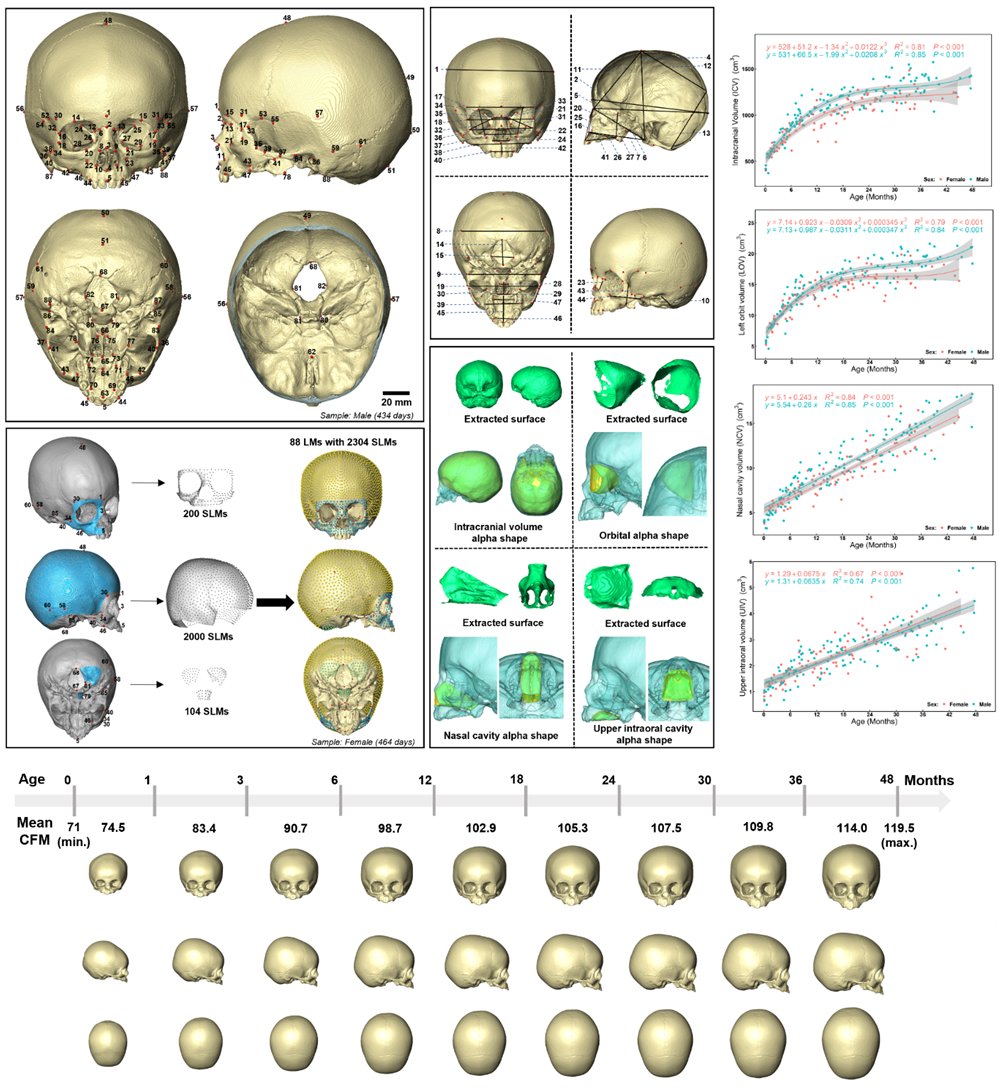 Mehran Moazen (@mehran_moazen) on Twitter photo Interested in how human #craniofacial #system #develop during #infancy, then have a look at rdcu.be/devHp <a href="/SciReports/">Scientific Reports</a> by <a href="/Liang_ce96/">Ce Liang</a> <a href="/AntProfico/">Antonio Profico</a> <a href="/RH_Khonsari/">Roman Hossein Khonsari</a> Buzi & O'Higgins #skull #growth <a href="/OxfordCranio/">Oxford Craniofacial Unit</a> <a href="/iphes/">IPHES-CERCA</a> <a href="/moazenlab/">Moazen Lab</a> <a href="/uclmecheng/">UCL MechEng</a> <a href="/UCLpress/">UCL Press</a> <a href="/uclnews/">UCL News</a> funded by <a href="/EPSRC/">Engineering and Physical Sciences Research Council</a> Interested in how human #craniofacial #system #develop during #infancy, then have a look at rdcu.be/devHp <a href="/SciReports/">Scientific Reports</a> by <a href="/Liang_ce96/">Ce Liang</a> <a href="/AntProfico/">Antonio Profico</a> <a href="/RH_Khonsari/">Roman Hossein Khonsari</a> Buzi & O'Higgins #skull #growth <a href="/OxfordCranio/">Oxford Craniofacial Unit</a> <a href="/iphes/">IPHES-CERCA</a> <a href="/moazenlab/">Moazen Lab</a> <a href="/uclmecheng/">UCL MechEng</a> <a href="/UCLpress/">UCL Press</a> <a href="/uclnews/">UCL News</a> funded by <a href="/EPSRC/">Engineering and Physical Sciences Research Council</a>