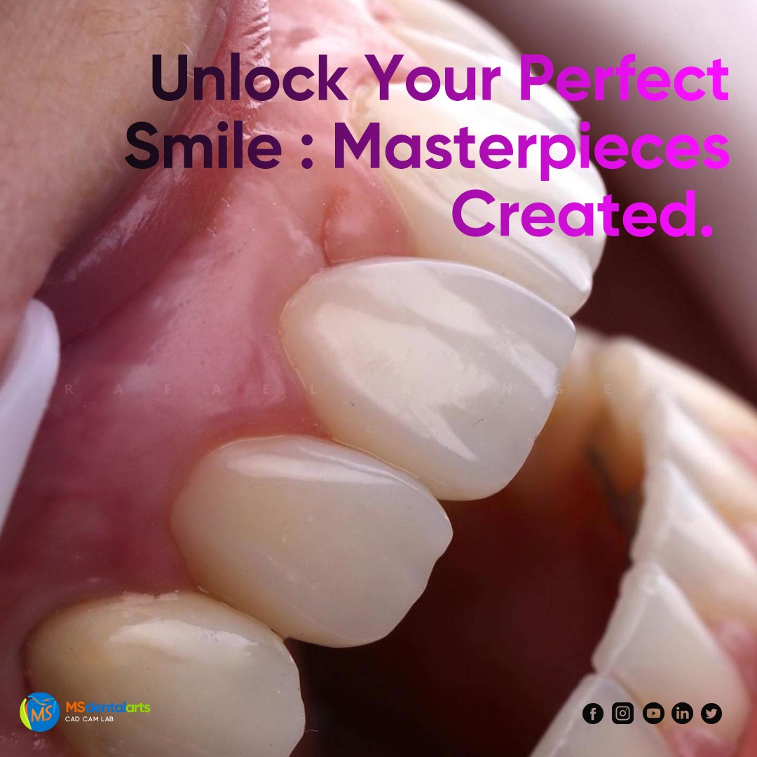 Teeth Whitening Machine: Unlock Your Perfect Smile Today!