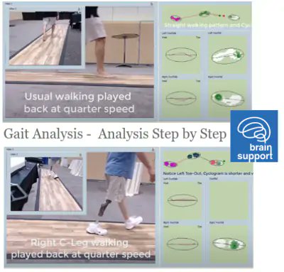 8° Encontro Paulista de Comportamento Motor - UNICID

Gait Analysis -  Analysis Step by Step

Dopaminergic modulation of timing control and variability in the gait of Parkinson's disease

theneurosoft.net/post/8-encontr…