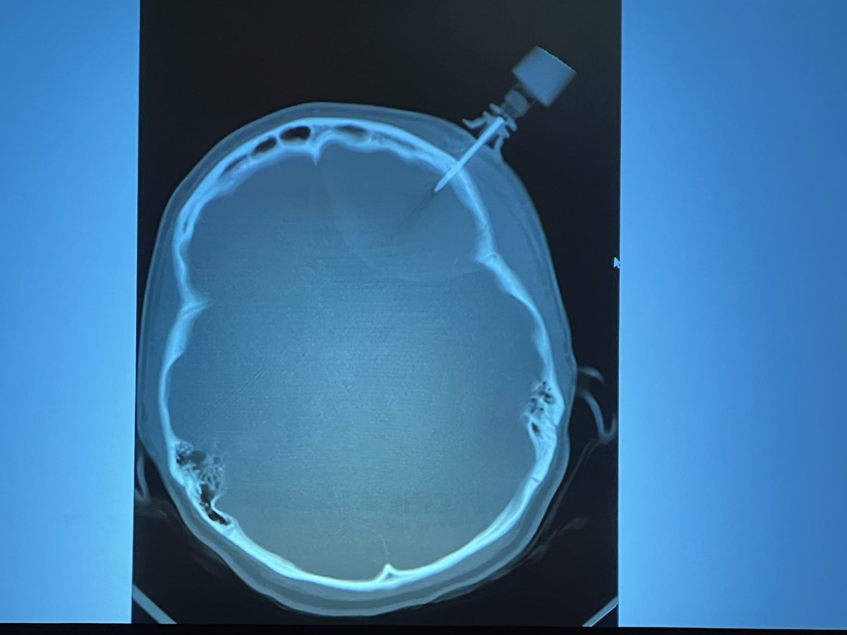 Peter Antevy tweet media