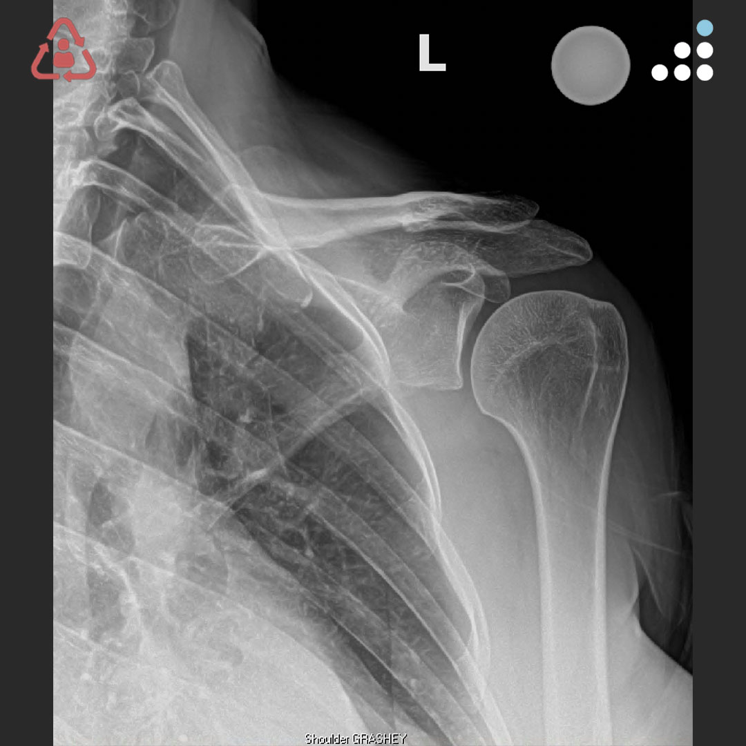 Orthobullets tweet media