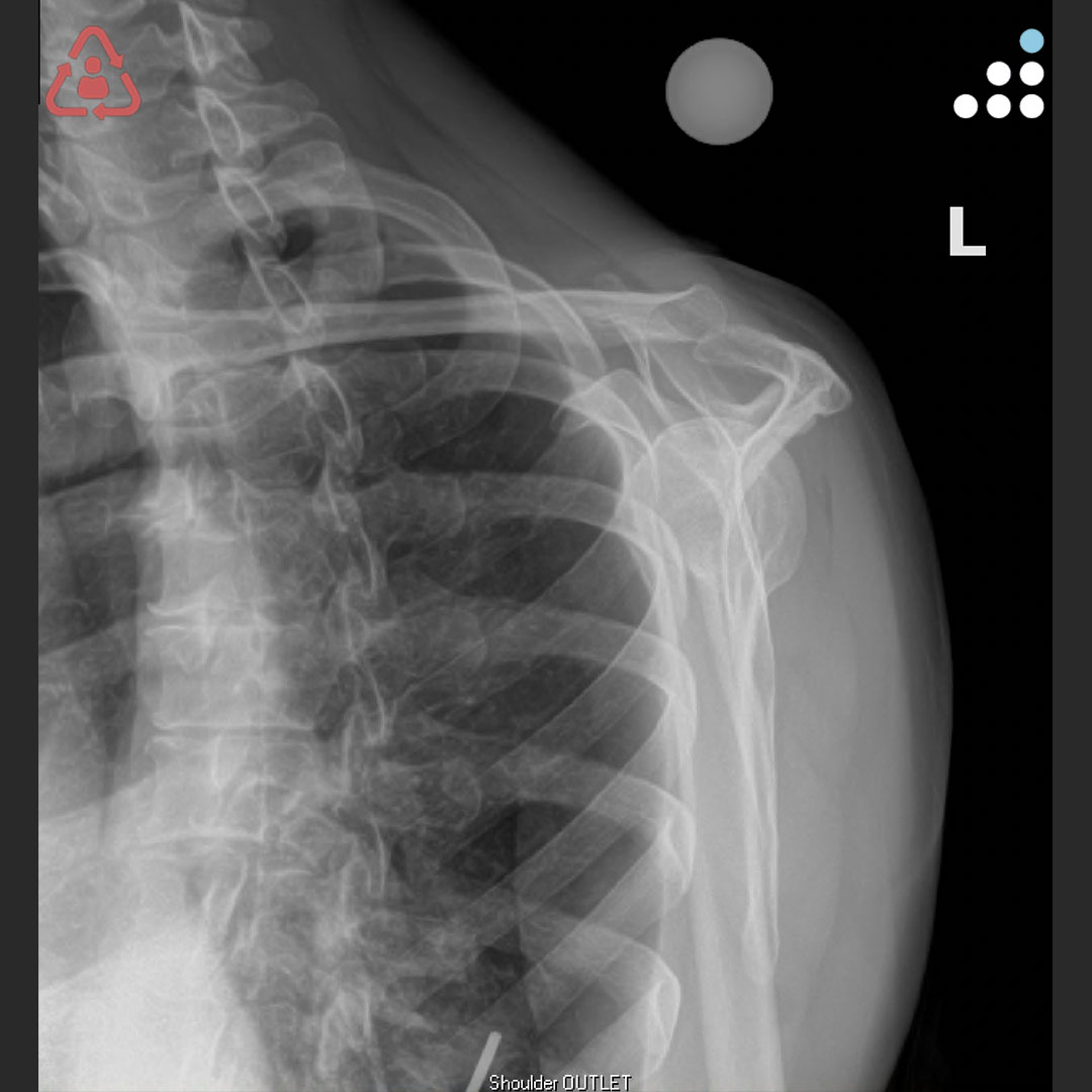 Orthobullets tweet media