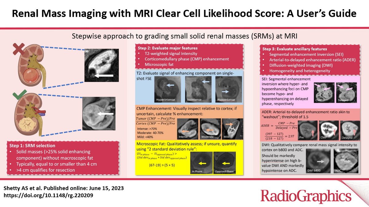 Learn more about how to use the MRI Clear Cell Likelihood Score (devised by @ivpedrosa and colleagues) in evaluating solid renal masses from our recently published work in @RadioGraphics @MIRimaging @WUSTLmed pubs.rsna.org/doi/10.1148/rg…