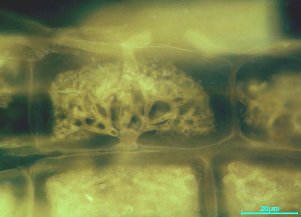 amf_sentoku's tweet image. 根の皮層細胞に形成されるアーバスキュラー菌根菌のarbuscule(樹枝状体）
自然の営み、ただただ美しい・・・