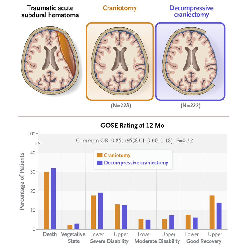 NEJM's tweet photo. Patients with traumatic acute subdural hematomas often require surgical evacuation with a craniotomy, in which the bone flap is replaced, or decompressive craniectomy, in which the bone flap is not replaced.

Read the full RESCUE-ASDH Research Summary: https://t.co/KoNebwQaCK