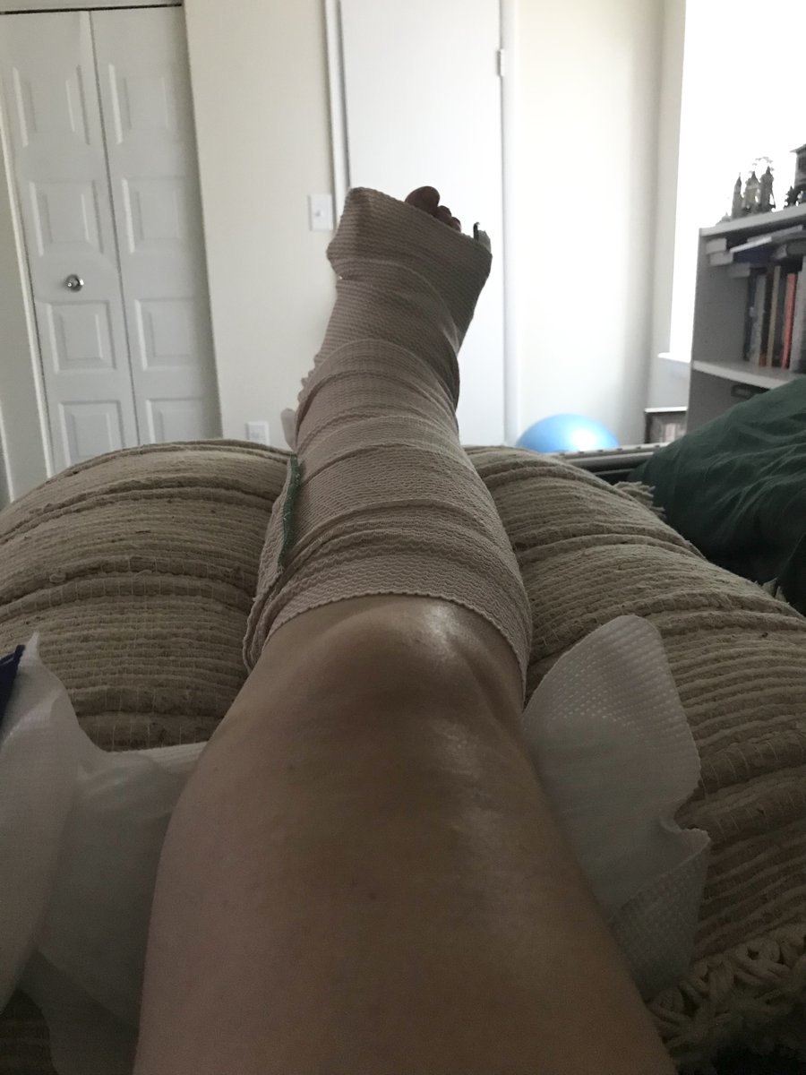 Hopefully this is the last step in the recovery process from this ankle injury that I'm still not sure how I sustained.

Here's to getting lots of rest, making a dent in my to-read pile and hopefully being back in the pool by the end of the summer!

#anklesurgery #roadtorecovery