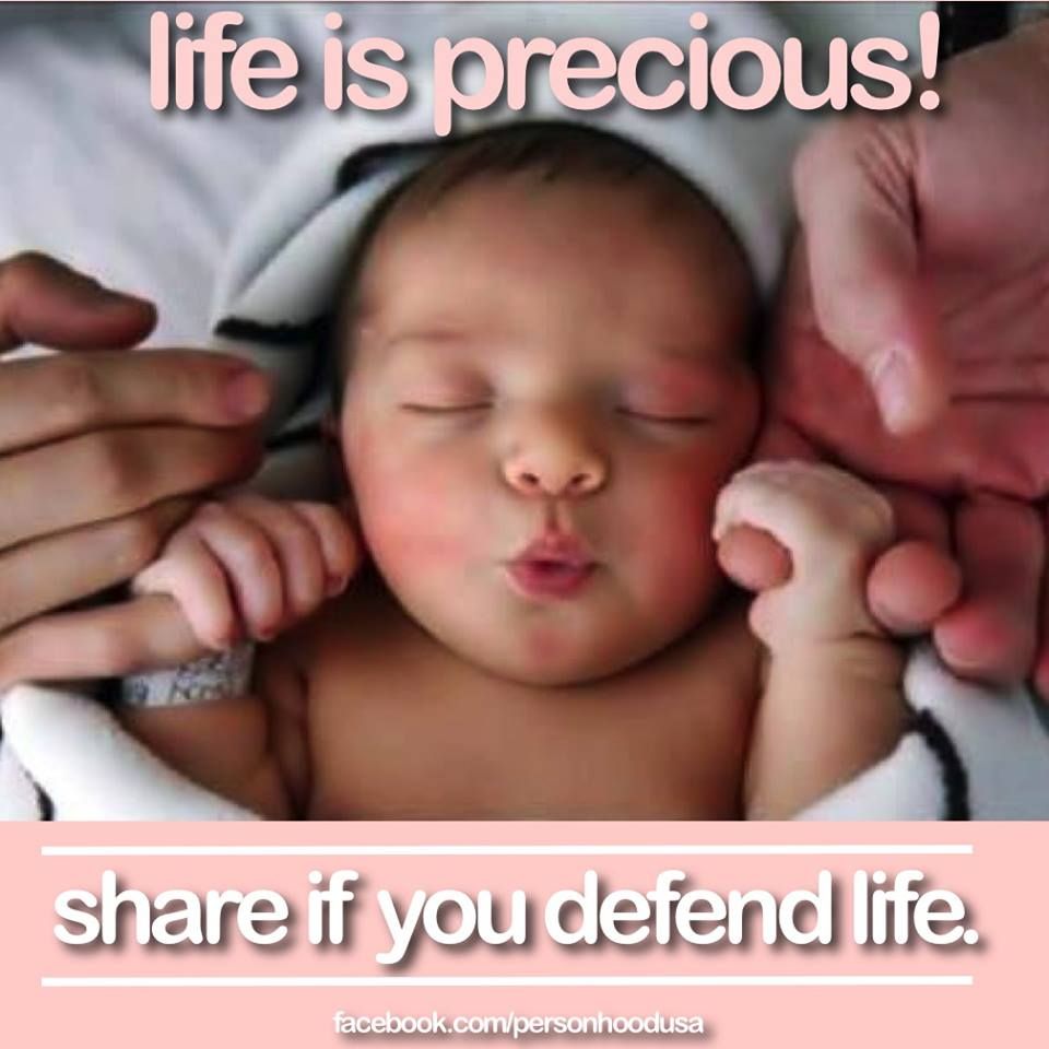 MurdoMMK's tweet photo. @DanikaF28100296 @HuxTweets @BPAS1968 It's so obvious that abortion is wrong it's staggeringly mindboggling on an epic scale how some can't see it. https://t.co/Kw4YsWTT5Y