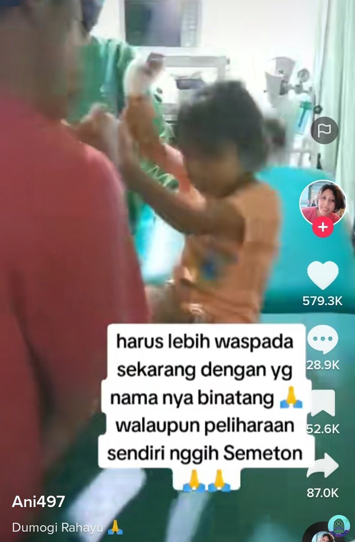 💚 CW // TIKTOK gais serius nanya, ini kalo kena rabies bener kaya gini? kasian bgt adeknya sampe meinggal digigit anjing peliharannya 😭 ns mintol drop videonya ya sblm w di amuk orang2..